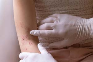 Department of Dermatology